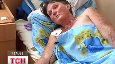 На Житомирщине битва за урожай фермеров выходит людям боком