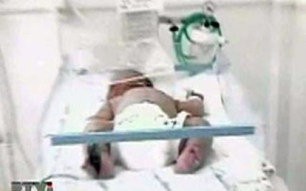 У Болгарії народилось немовля з рекордною вагою