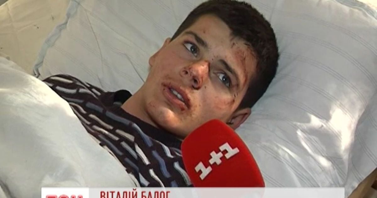 На Закарпатті підлітки постраждали в аварії