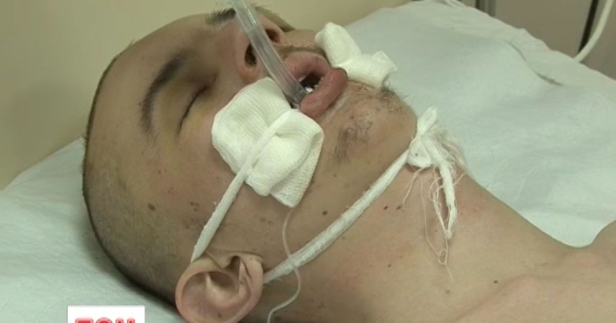 У Чернігові шукають родичів і друзів постраждалого