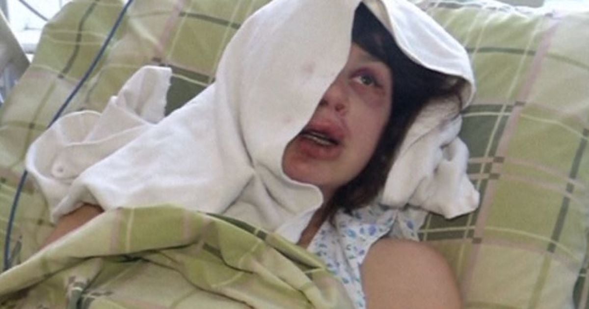 Чорновол вважає причиною побиття свою журналістську і громадську діяльність