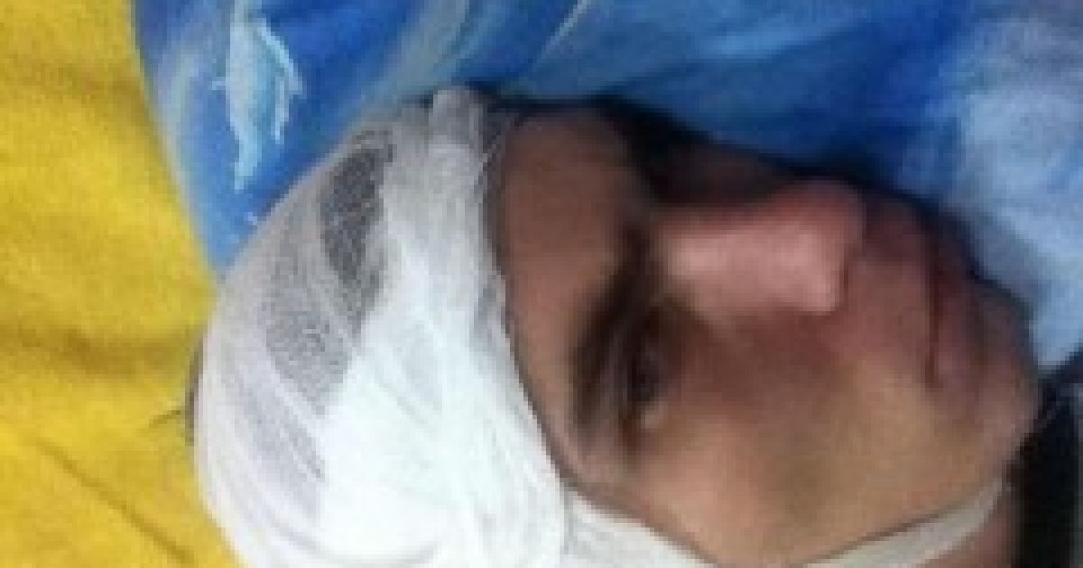 Побитому хлопцю наклали 16 швів