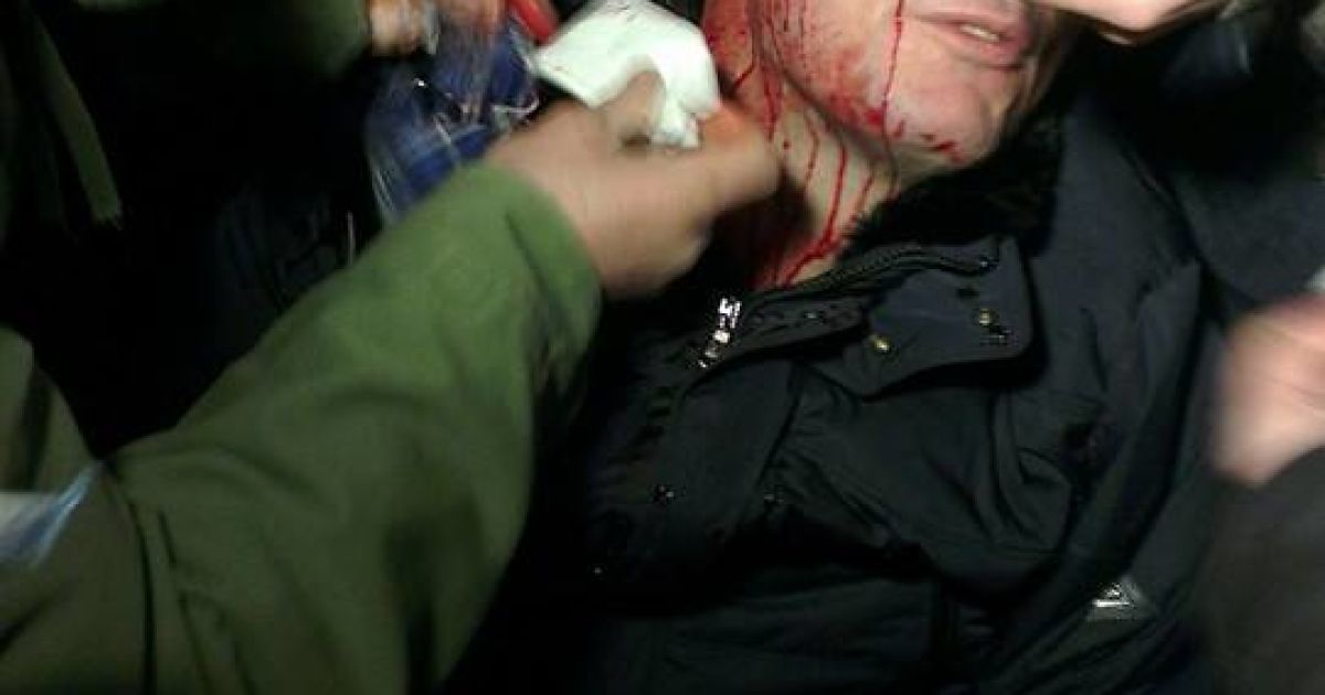 Побитий "Беркутом" Юрій Луценко. Фото Андрія Ковальова / © Facebook