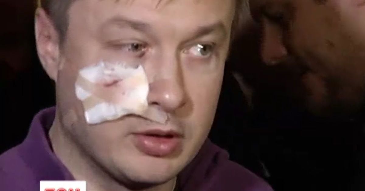 Кізіну пошкодили щоку