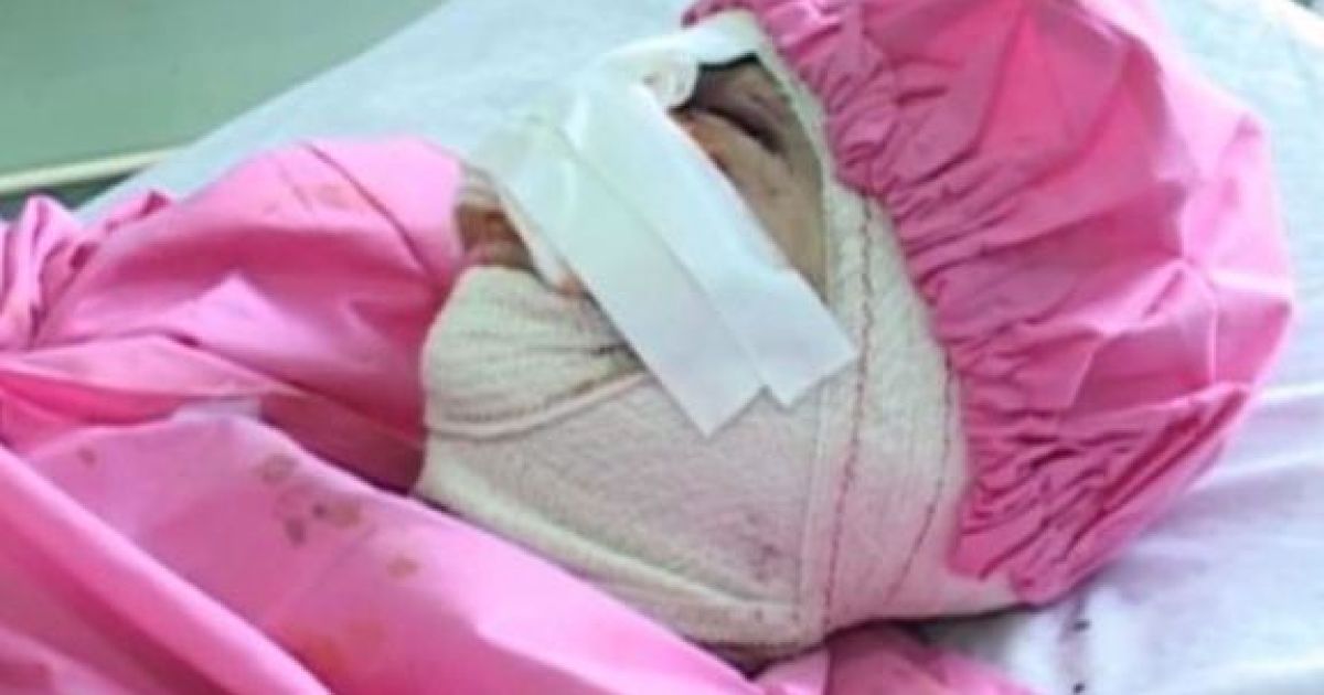 Наркоман відрізав дружині носа і губи через гроші героїн