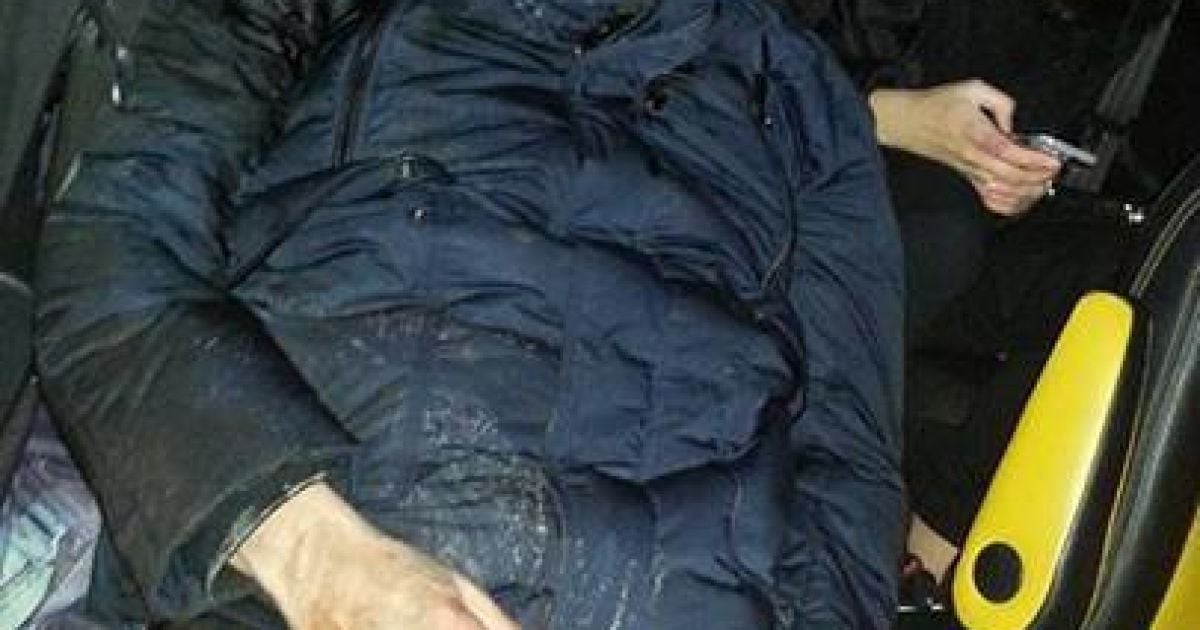 Луценку зашили величезну рану на голові