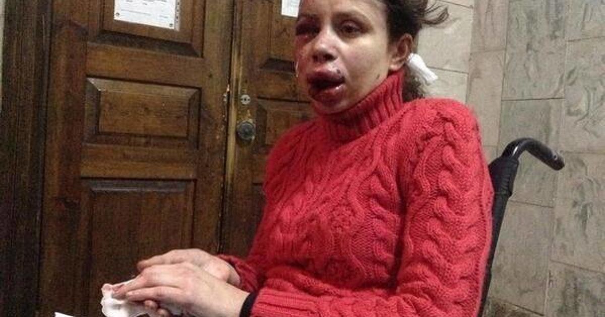 Тетяну Чорновол побили сьогодні вночі