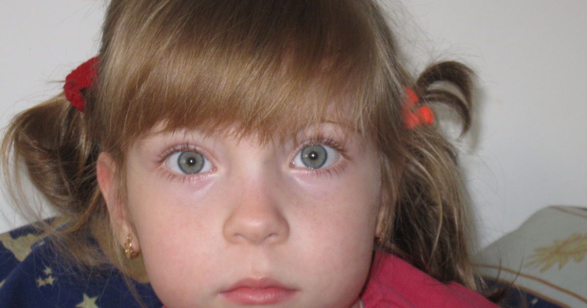 5-річна Ганнуся потребує допомоги!