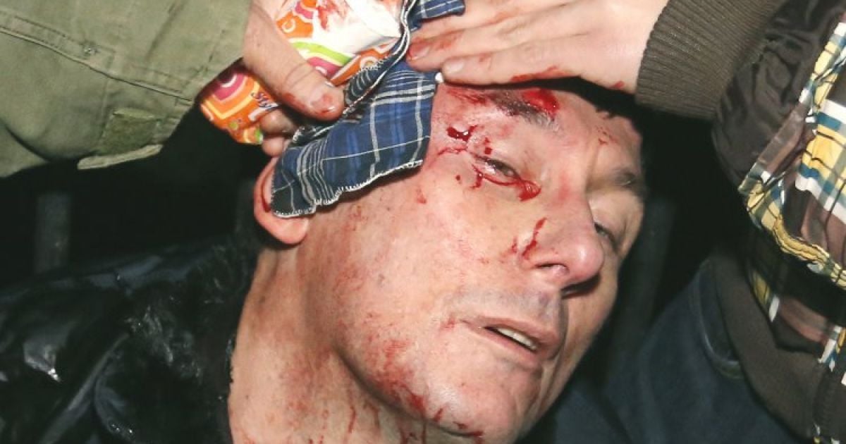 В &laquo;Беркуті&raquo; запевняють, що Луценко сам впав і розбив голову