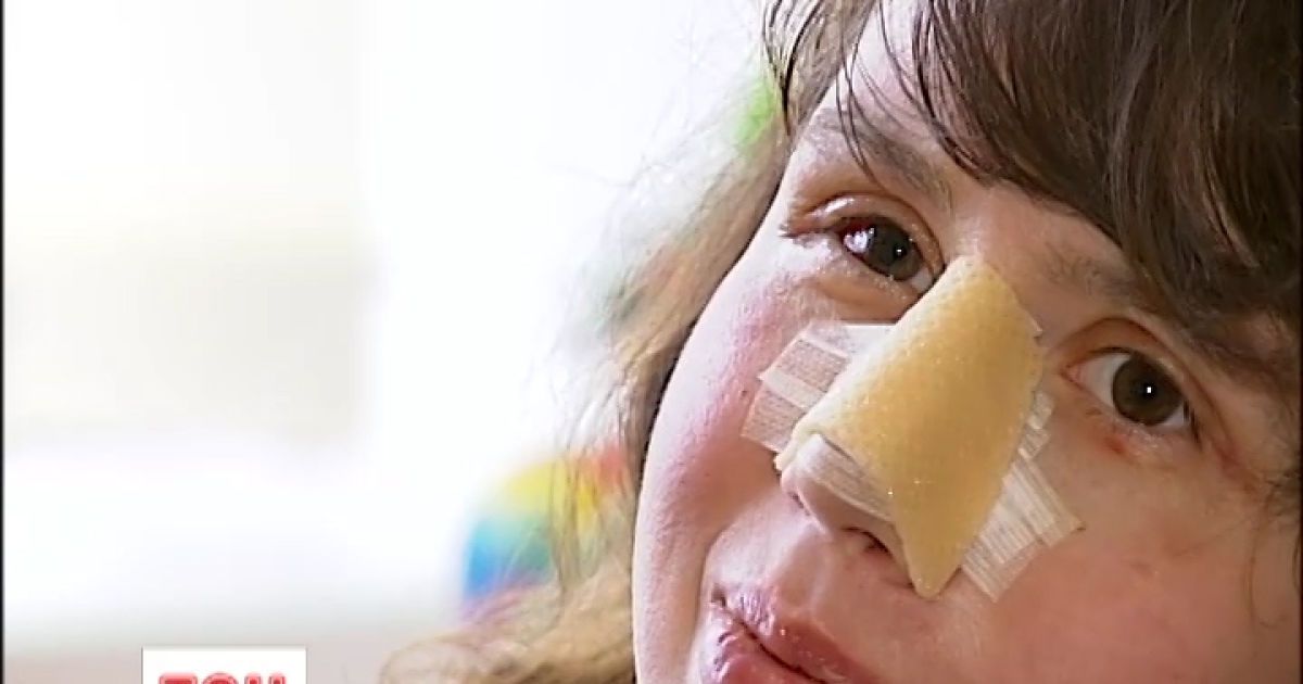 Стан здоров&#039;я Чорновол досі викликає занепокоєння в медиків