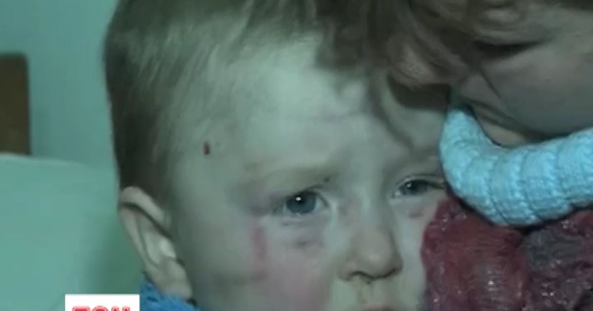 Дитина померла від черепно-мозкової травми