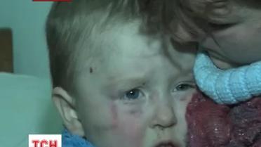 На Вінниччині п'яний вітчим забив до смерті 6-річного пасинка