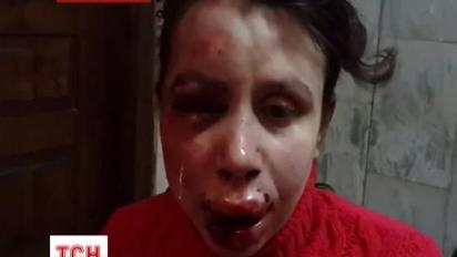 Міліція затримала двох підозрюваних у побитті Тетяни Чорновол