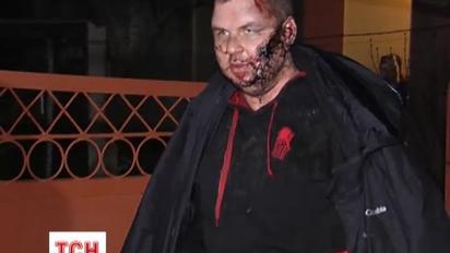 Спеціалісти підозрюють, що викрадачі дислокуються у Бориспільському районі