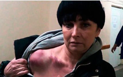 В Киеве неизвестный избил журналистку и пытался ее задушить
