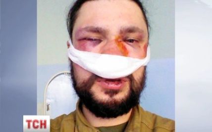 В Киеве от силовиков пострадал 21 журналист, у многих переломы, одному пуля попала в лоб