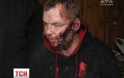 З'явилось перше відео з ледь живим після катувань Дмитром Булатовим