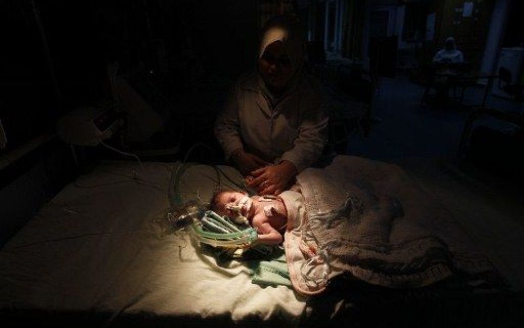 Місто Газа. Дитина отримує лікування у відділенні інтенсивної терапії в лікарні міста Газа. / © AFP