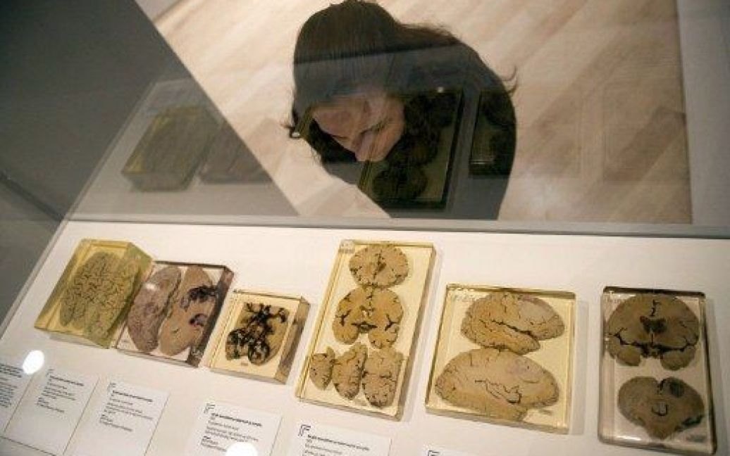 Великобританія, Лондон. Жінка роздивляється експонати на виставці "Мозок: свідомість матерії" в Лондоні. / © AFP