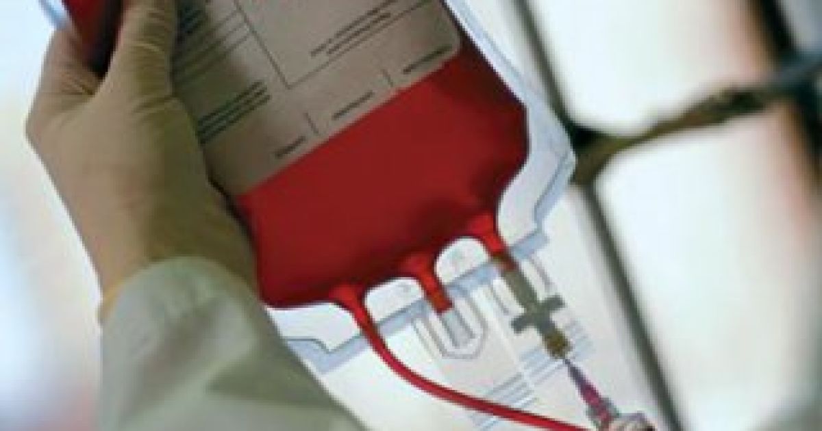 Рак крові вилікували за допомогою ВІЛ.