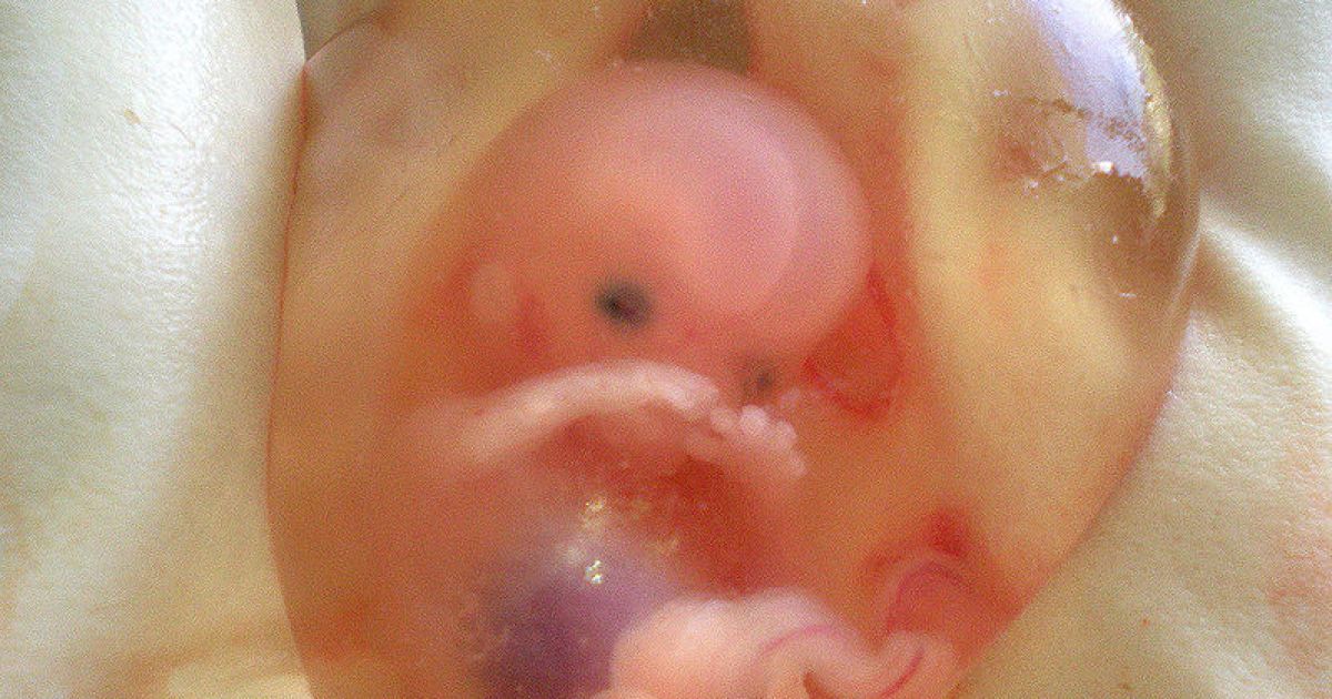 В Україні зменшилася кількість абортів