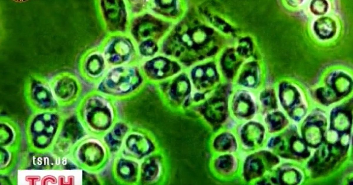 Хламідіоз загрожує безпліддям обом статям