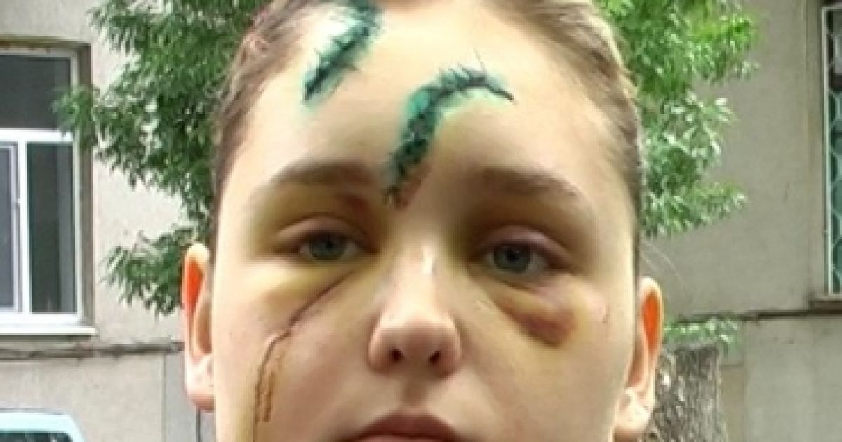 Мікроавтобус, в якому їхав фольклорний ансамбль "Славутянка" зіткнувся з вантажівкою
