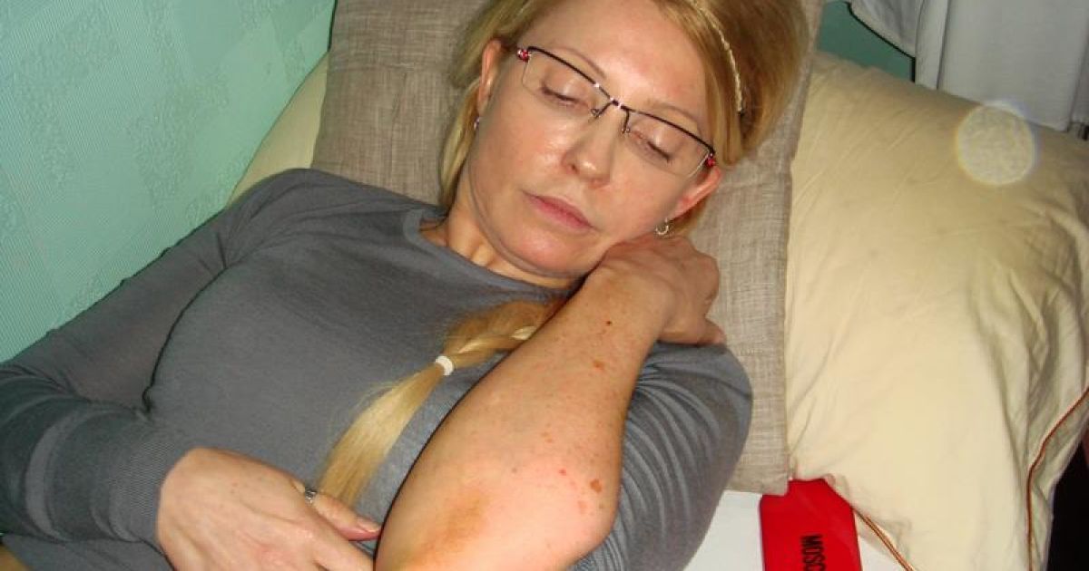 Юлія Тимошенко показала синці / © facebook.com/Портніков