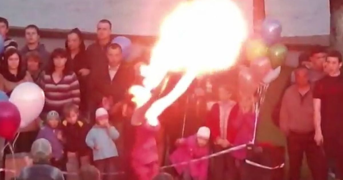 Дівчина намагалася загасити полум'я, проте воно лише перекидалося на руки і волосся