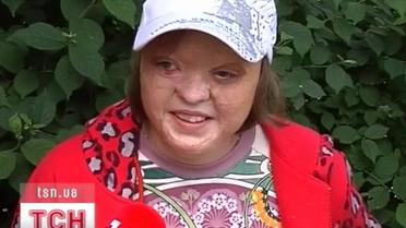 Допомога потрібна 13 річній Іринці Пантелеймоновій з Миколаєва