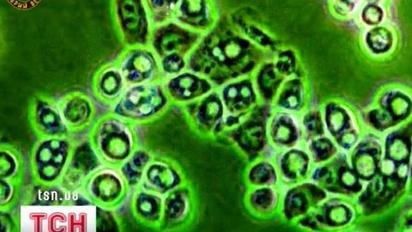 Хламідіоз може дістати захист від усіх відомих антибіотиків