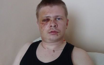 Побитий співвласник "Дорожнього контролю" розповів, за що йому могли помститися