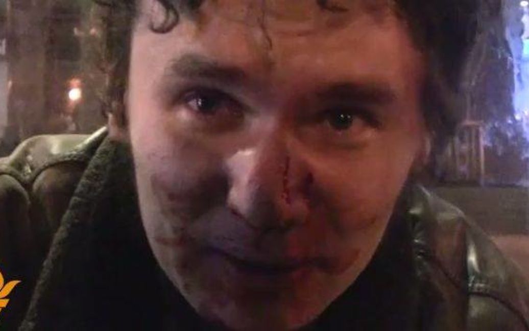 Поранені стікають кровʼю / © Радіо Свобода