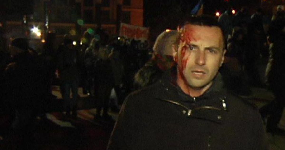 Поранені стікають кровʼю