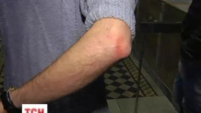 У Києві Беркут побив сімох активістів зі Львова