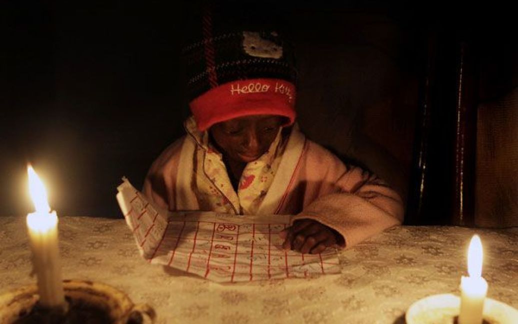 У південноафриканському місті Хеврон живе 12-річна Онтламетсе Фаласте, яка є єдиною в світі темношкірою дитиною, що страждає на синдром Гетчінсона-Гілфорда. / © bigpicture.ru