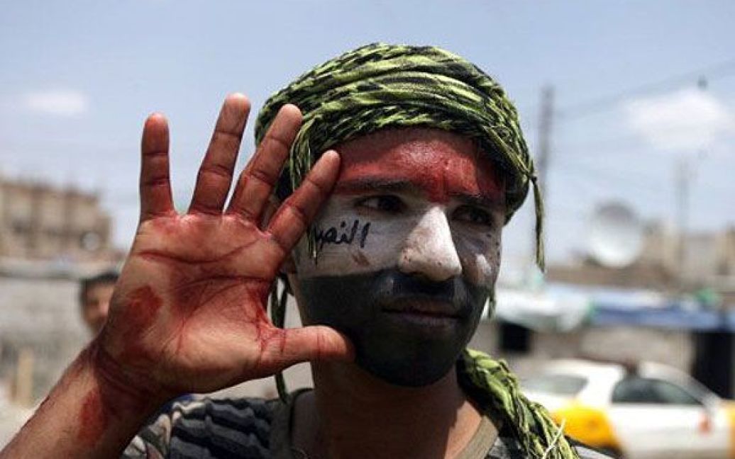 Ємен, Сана. Єменський антиурядовий демонстрант показує свої руки, вкриті кров&rsquo;ю після того, як він допомагав товаришам, пораненим під час зіткнень між антиурядовими демонстрантами і силами безпеки в Сані. / © AFP