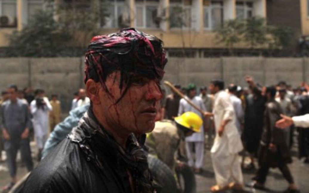 Афганістан, Кабул. Поранений учасник мітингу спостерігає за боротьбою між протестувальниками та поліцейськими. Заворушення спалахнули через вбивство члена плем&rsquo;я Кучі охоронцем депутата. / © AFP