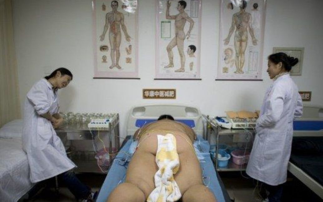 Китай, Пекін. Дитині, яка бере участь у програмі з втрати ваги та боротьби з дитячим ожирінням, проводять медичні процедури в одній з лікарень Пекіна. Дослідники виявили, що в Китаї майже кожна п&#039;ята дитина у віці до семи років має надлишкову вагу. / © AFP