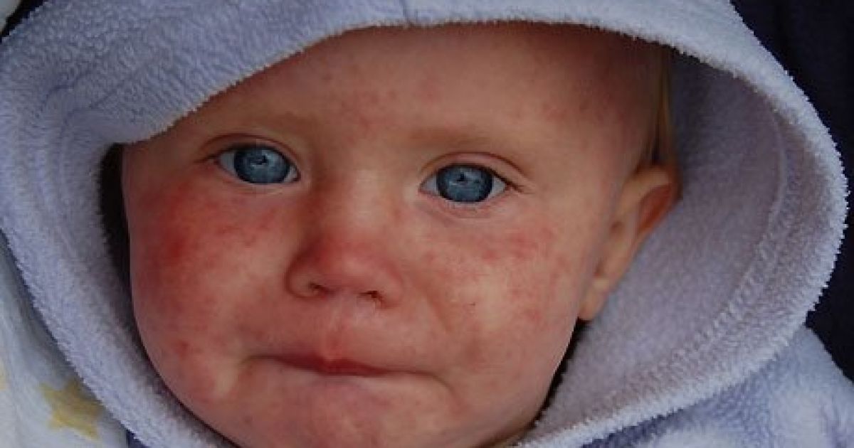 Ілюстрація