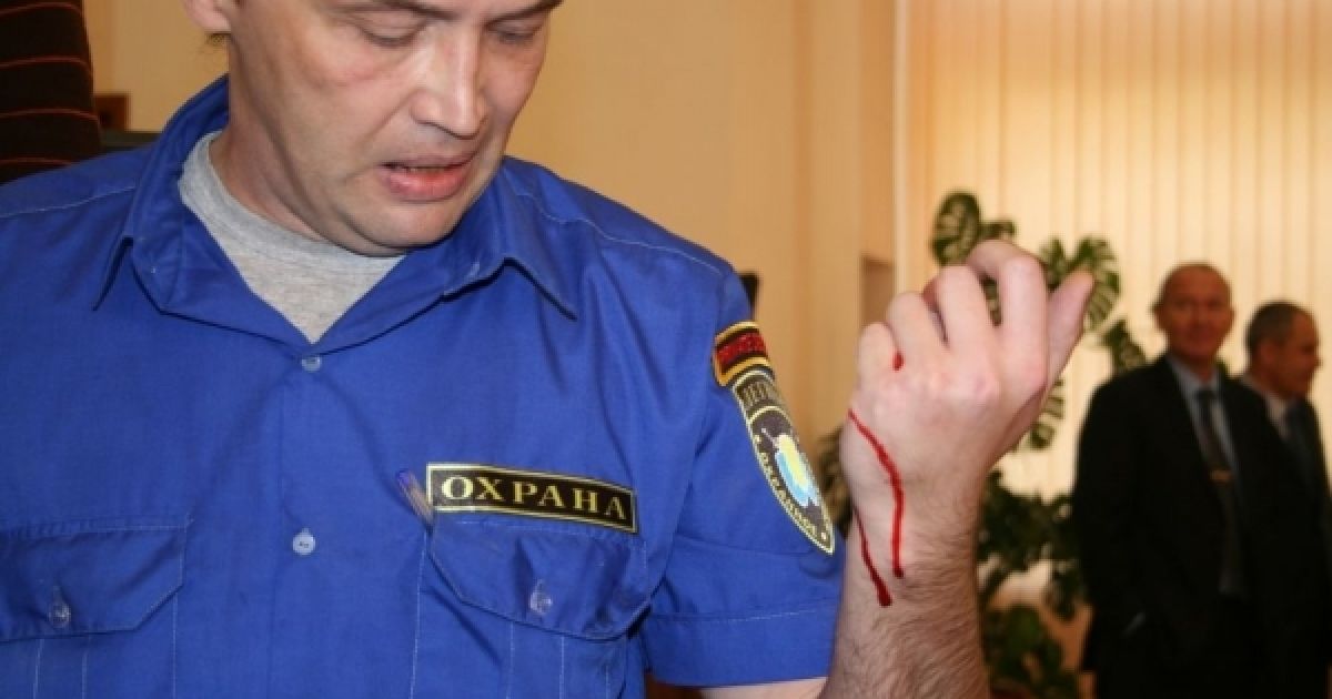 Під час сутички на засіданні Луганської міськради активіст громади Михайло Пащук відкусив фалангу пальця охоронцеві. / © Новости Луганска