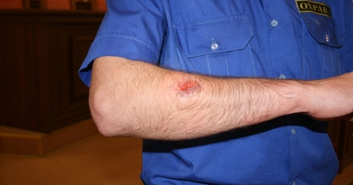 Під час сутички на засіданні Луганської міськради активіст громади Михайло Пащук відкусив фалангу пальця охоронцеві. / © Новости Луганска