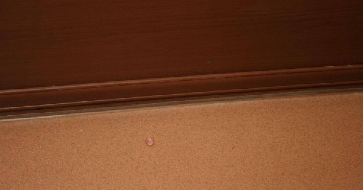 Під час сутички на засіданні Луганської міськради активіст громади Михайло Пащук відкусив фалангу пальця охоронцеві. / © Новости Луганска