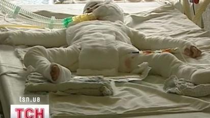 Понад місяць лікарі борються за життя 4-річного Ернеста Грищука