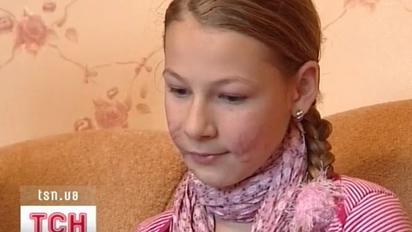 102 гривні штрафу за напад пітбуля на дітей