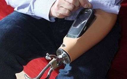 Однорукий британець вмонтував смартфон у протез
