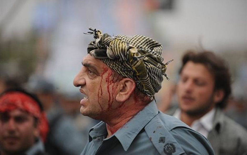 Поранений офіцер поліції віддає накази під час сутички із демонстрантами у Кабулі. Розлючені афганці вийшли на демонстрацію після загибелі кількох людей у аварії, яка сталася з вини водія машини, що належить посольству США. / © AFP