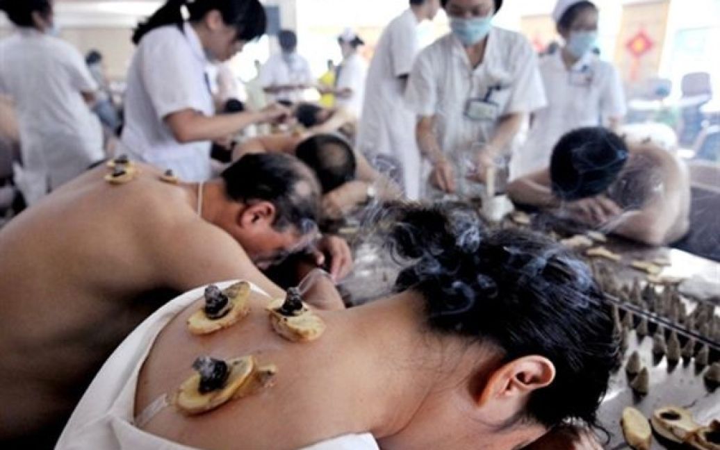 Сеанс акупунктури у одній з лікарень Фучжоу. Народна медицина застосовується у Китаї як для попередження хвороб, так і під час післяопераційної реабілітації. / © AFP