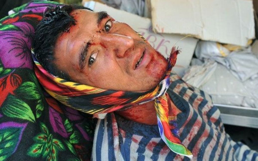 Кількість загиблих в результаті міжетнічних заворушень на півдні Киргизії зросла до 104 людей, більше 1200 постраждали / © Getty Images/Fotobank