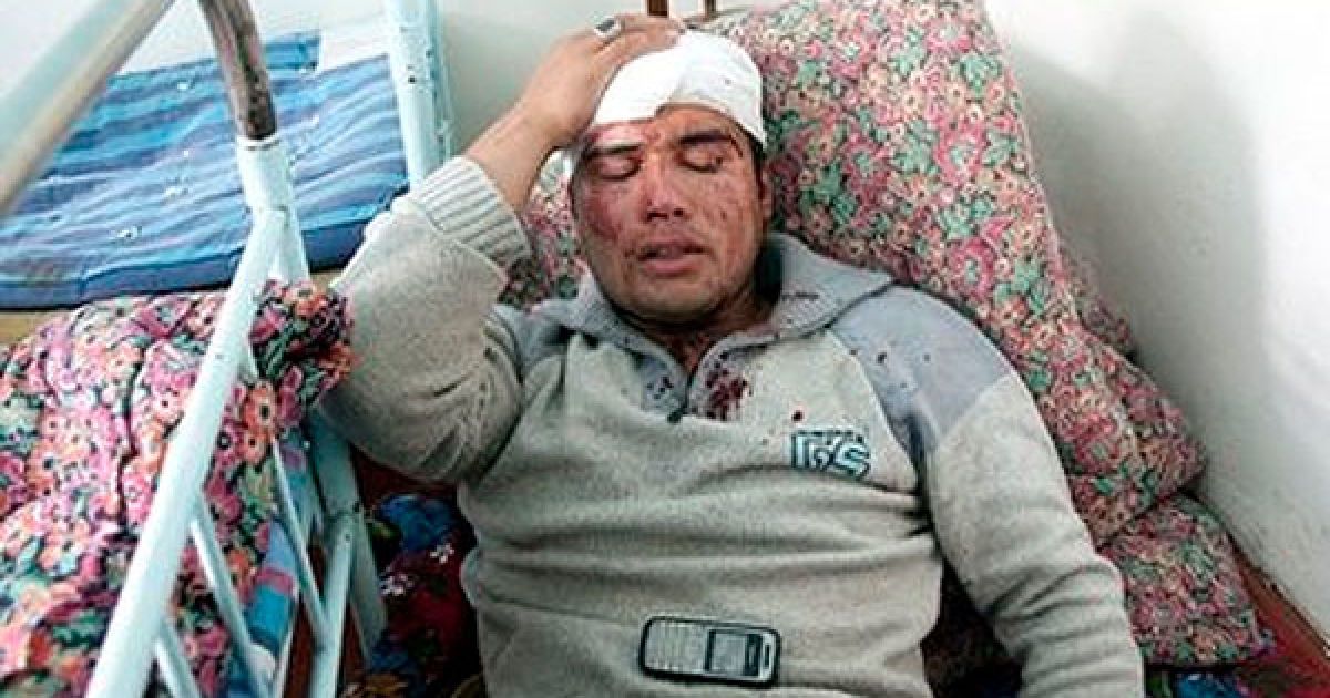 В результаті міжетнічних зіткнень між киргизами та узбеками на півдні Киргизії загинули більше сотні людей, тисячі постраждали. / © 24.kg